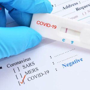 Danh sách kit test nhanh COVID-19 được Bộ Y tế phê duyệt